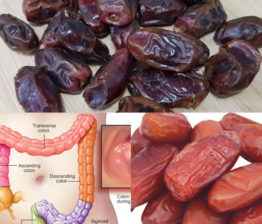 Intestinal Cleansing with Dates: A Natural Detox Strategy