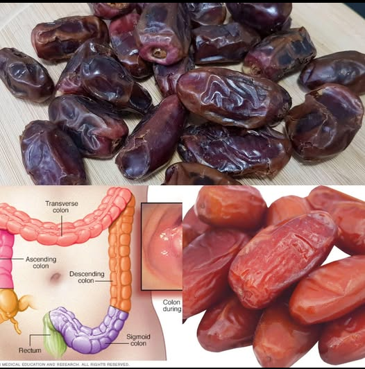 Intestinal Cleansing with Dates: A Natural Detox Strategy