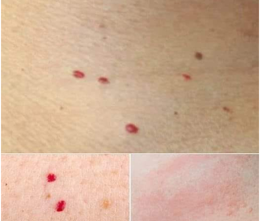 Red Spots on Your Skin: Potential Causes and What They Could Signify