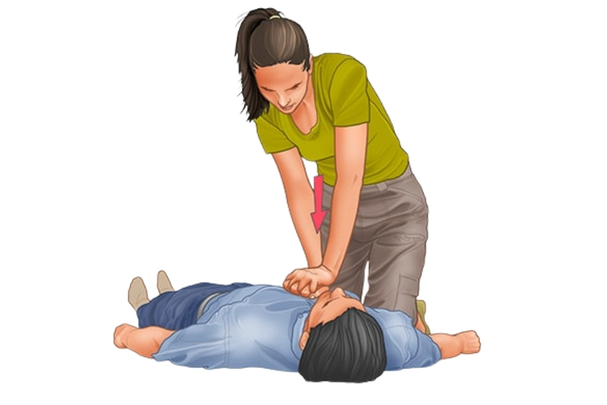 Cardiopulmonary Resuscitation (CPR)